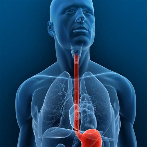 esophageal cancer